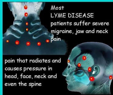 LYME_DISEASE.png