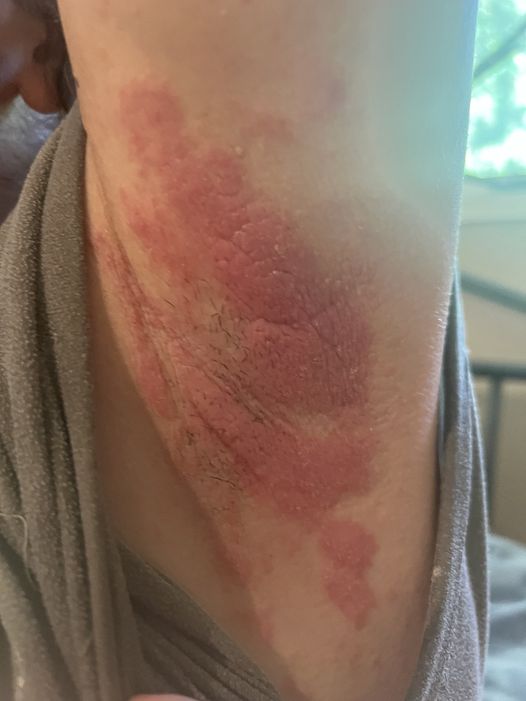 armpit.jpg